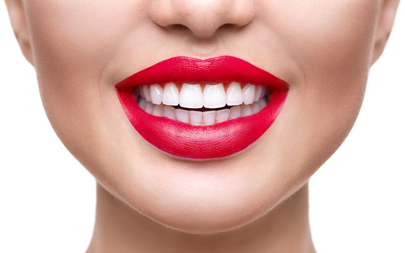 Best ways to whiten your teeth